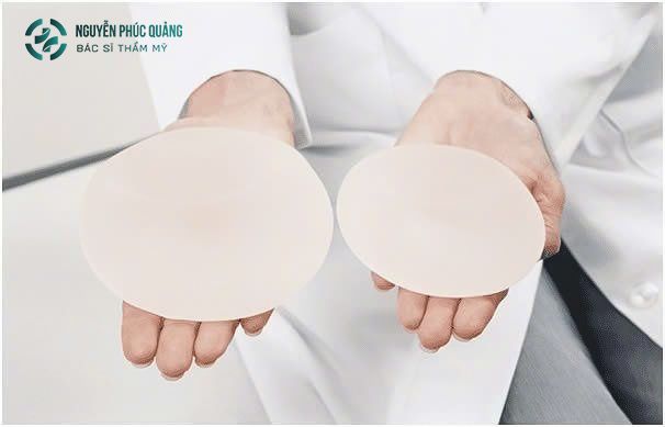 Nâng ngực có nguy hiểm không, được bao nhiêu năm?
