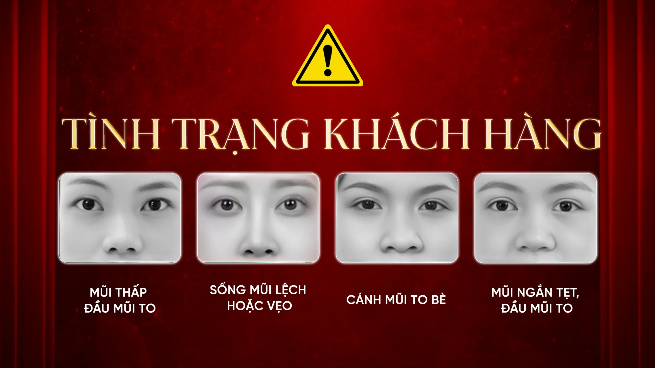 THẨM MỸ NÂNG MŨI